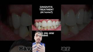 GINGIVITIS AT HOME TREATMENT gumdisease periodontist gumdisease [upl. by Anileme157]