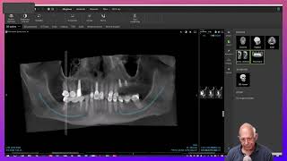 Dental Treatment Planning in a Medically Compromised Case [upl. by Svirad700]