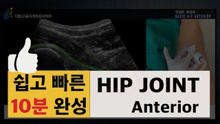 Hip joint anterior scan KAOM 강사 이근우 구미 마디와신경외과 친절한 초음파 대한근골격계초음파학회 [upl. by Blodget]