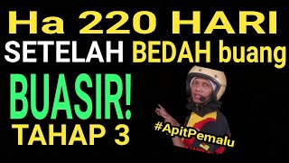 Ha 220 hari setelah pembedahan buasir tahap 3 di hospital KPJ Seremban kos 8600 lebih berak berdarah [upl. by Crabb]