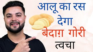 आलू का रस देगा बेदाग़ गोरी त्वचा Skin Whitening amp Pigmentation Treatment with Potato Juice [upl. by Alym]