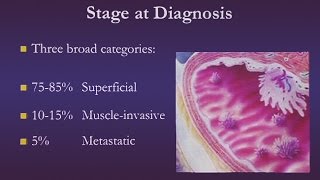 Bladder Cancer [upl. by Jordan]