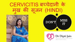 बच्चेदानी के मुख की सूजन  कारण और इलाज  CERVICITIS  UTERUS INFECTION  PID [upl. by Hole284]