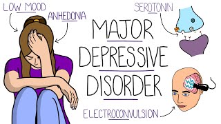 Depression Explained Major Depressive Disorder [upl. by Nairrod]