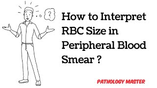 Importance of RBC Size in Peripheral Blood Smear  Made easy  Microcytic amp Macrocytic anemia [upl. by Eustacia]