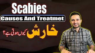 Scabies Ki Pehchan Aur Iska Ilaj \ Dr Shoaib Ke Sath \ The Medbros \ خارش کا علاج [upl. by Deryl]