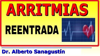 ARRITMIAS 6 REENTRADAS como causa de arritmia cardíaca [upl. by Esetal]