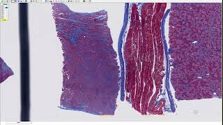 Histologic Review of Monensin Toxicity in a 12monthold Calf [upl. by Kalindi]