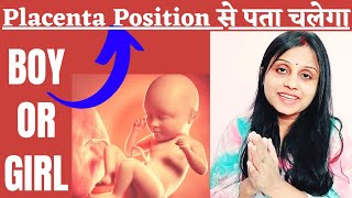 Gender Prediction Symptoms in Pregnancy Posterior Placenta से कैसे पता करे गर्भ में बेटा या बेटी है [upl. by Llednahc]