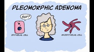 Pleomorphic Adenoma [upl. by Fuhrman]