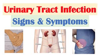 Urinary Tract Infection UTI Signs amp Symptoms amp Why They Occur [upl. by Alimaj773]