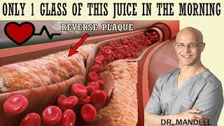 1 GLASS OF THIS JUICE IN THE MORNINGREVERSE CLOGGED ARTERIES amp LOWER HIGH BLOOD PRESSURE [upl. by Diaz]