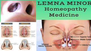 Lemna minor homeopathy medicine in hindi by Premwati Yadav [upl. by Ahsinek]