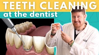 How Teeth Cleaning Works Deep cleaning vs Regular cleaning [upl. by Georges]