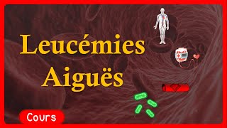 🎗️ Leucémie Aigue 🩸  symptômes🤧 traitements💉  Cours  Hématologie [upl. by Yancey603]