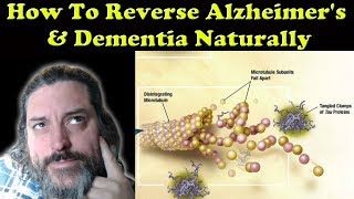 How To Reverse Alzheimers amp Dementia Naturally [upl. by Siraj]