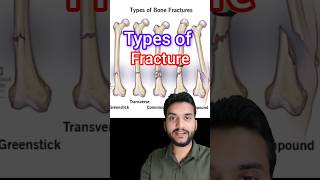 Fracture Types shorts [upl. by Salahi981]