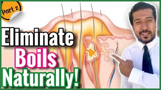 5 Natural Ways to Get Rid of Boils  Treat a Boil at Home FAST [upl. by Kcirtap]