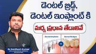 The Main Differences Between Dental Bridge amp Dental Implants  Eledent Dental Hospitals [upl. by Fortunio]