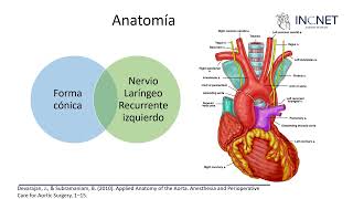 Conducto arterioso persistente [upl. by Braynard]