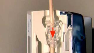 Fresenius Kabi Applix Smart INSTALLING THE GIVING SET [upl. by Nahtanoy]