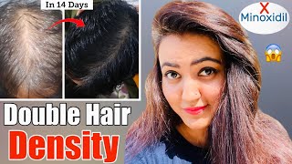 14 Days Challenge  Try This Hair Growth Remedy To Get Double Hair Density amp Thick Long Hair❤️ [upl. by Docilu]