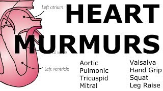 Heart Murmurs  Locations Maneuvers Buzzwords [upl. by Nimzaj]