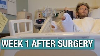 1 WEEK After Back Surgery [upl. by Aihsekyw]