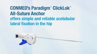 Paradigm™ ClickLok™ AllSuture Anchor  CONMED Product Video [upl. by Ogaitnas]