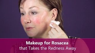 Makeup for Rosacea that Takes the Redness Away  Makeup for Older Women [upl. by Aynekal]