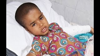 Malaika Abid Success Story  Anorectal Malformation [upl. by Klapp]