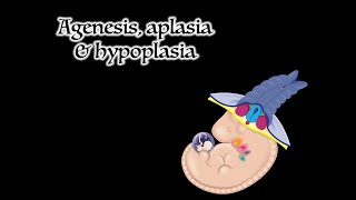 Agenesis Aplasia and Hypoplasia [upl. by Justinn]