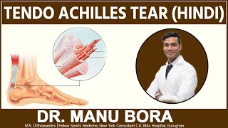 Tendo Achilles Tear  Hindi   Dr Manu Bora [upl. by Alebasi]