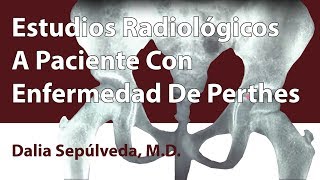 Estudios Radiológicos A Paciente Con Enfermedad De Perthes [upl. by Rainie]