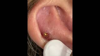 Piercings en apuros piercing piercer videopiercing failpiercing [upl. by Bender]