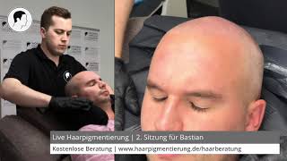 Live Haarpigmentierung  2 Sitzung für Bastian  Oberkopf maximal  Modern Hair Loss Solution [upl. by Leaw]