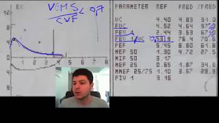 Spirometrie 4  exemplu DVO disfunctie ventilatorie obstructiva [upl. by Einad401]