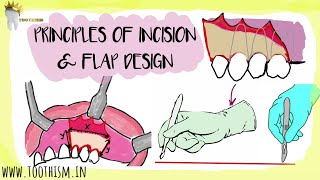 Principles of INCISION MAKING and FLAP DESIGN  Basic Principles of Oral Surgery [upl. by Gschu]