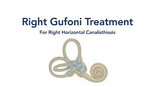 At Home Right Gufoni Treatment for BPPV Vertigo [upl. by Brandi446]