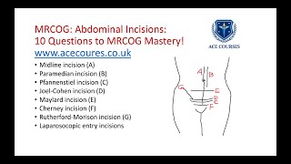 Abdominal incisions for the MRCOG exam MRCOG Mastery in 10 Questions Series from ACE Courses [upl. by Akemyt]