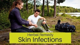 Best Herbal Remedy for Skin Infections [upl. by Moriah]