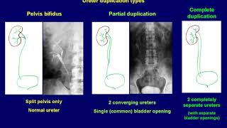 Intravenous Urography basics [upl. by Udelle105]