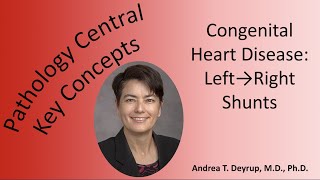 Medical School Pathology Pathophysiology of Congenital Heart Disease Left to Right Shunts [upl. by Tanah]