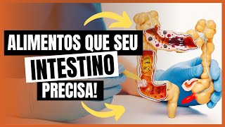 COMO ALIMENTAR SEU INTESTINO DICAS ESSENCIAIS [upl. by Valonia832]