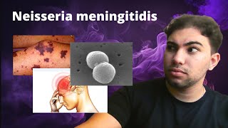 Neisseria Meningitidis  Meningite Meningocócica e Meningococcemia grave [upl. by Cheatham525]