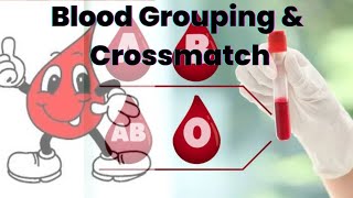 Blood Typing and Crossmatching  Blood Grouping  Blood Transfusions [upl. by Garrard382]