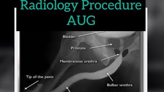 AUG  RUG  Radiographer  Radiology procedure  ascending urethrogram  urology [upl. by Ahsinyar]