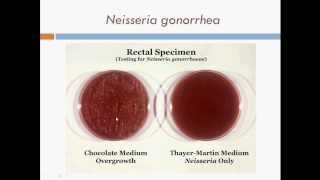 Bacteriology Diplococcus Gram Negative Cocci [upl. by Bastien]