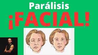 Acupresión Parálisis Facial quotRecupera la Normalidadquot [upl. by Benton]