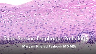 Esophagus Pathology slide session Maryam K Pezhouh MD MSc [upl. by Saire812]